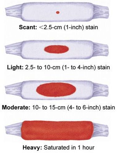 Implantation spotting vs light period vs heavy period