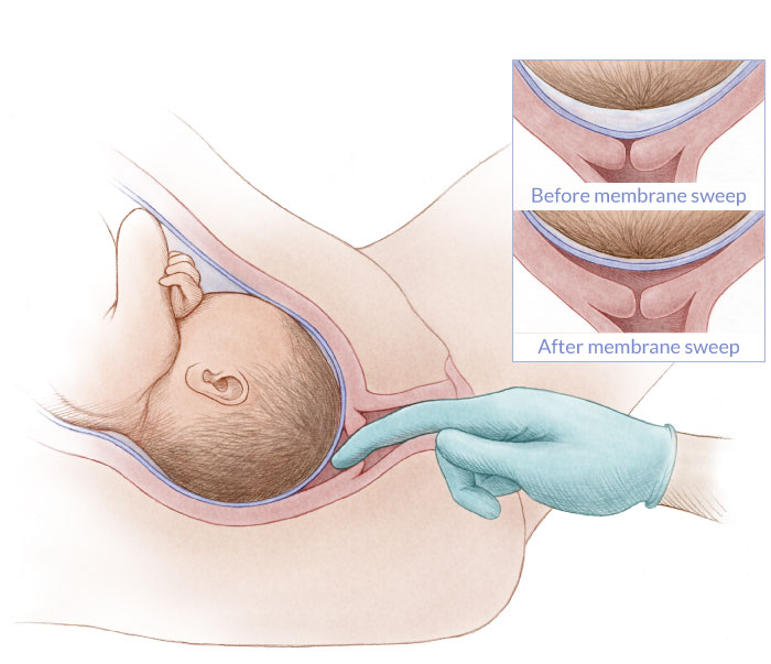Membrane sweep or stretch and sweep membrane stripping