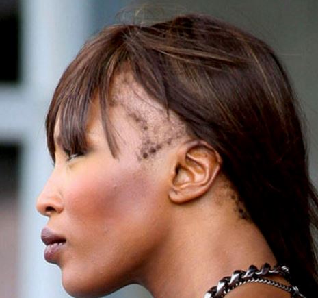Hair Styles For Womens Receding Hair | hairstyles for receding hairline at temples female Hair Styles For Womens Receding Hair | hairstyles for receding hairline at temples female